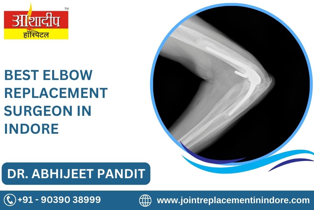 Best Elbow Replacement Surgeon In Indore