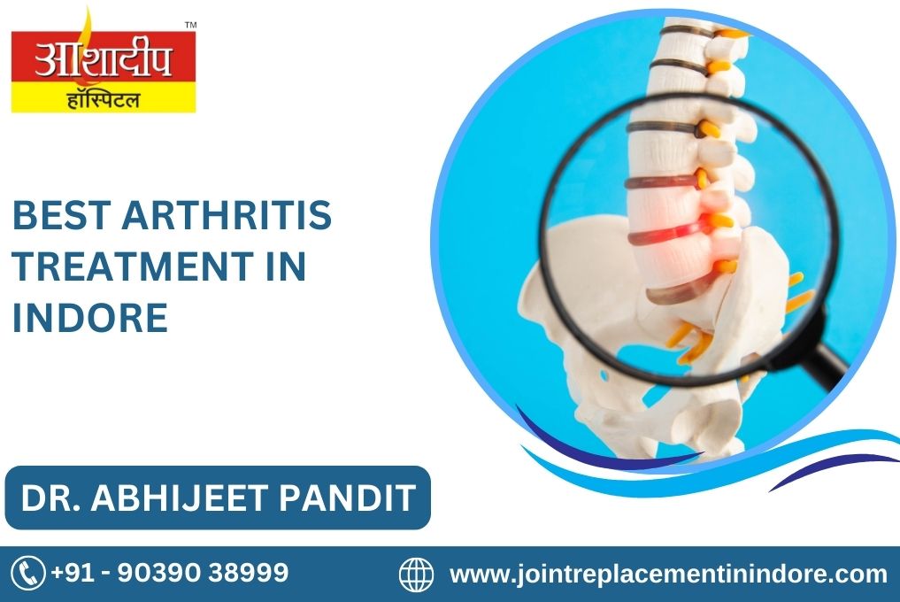 Best Arthritis Treatment In Indore