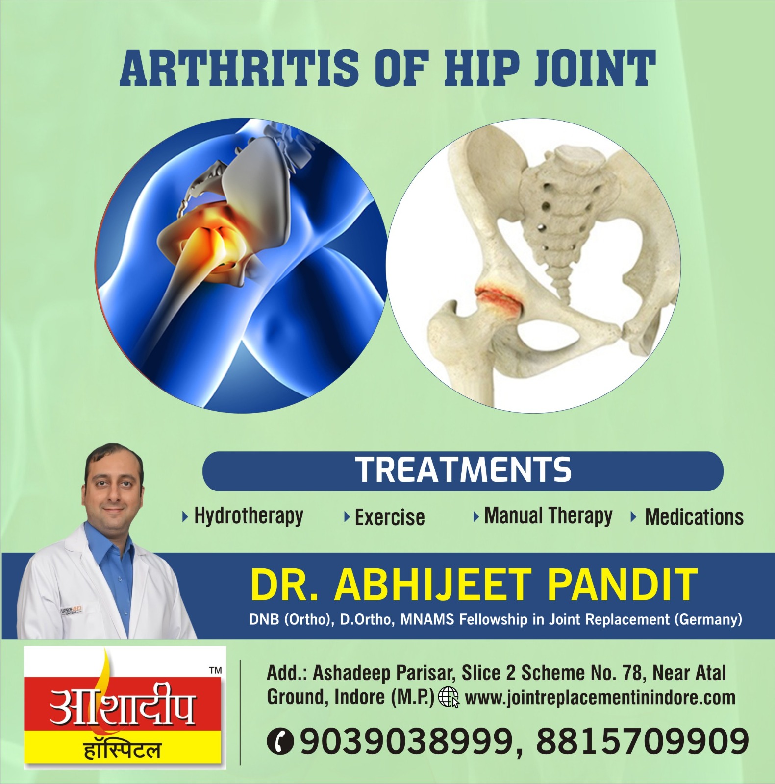 Best Doctor for Arthritis Hip Joint Treatment in Indore